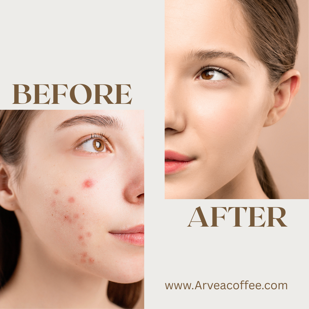 Glow Naturally: 10 Amazing Skin Care Benefits of Arvea Coffee
